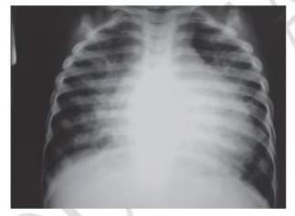 Imagem da questão 1